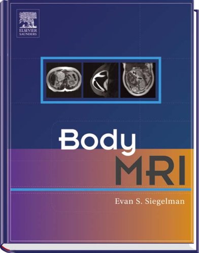Body MRI
