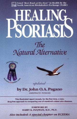 Healing Psoriasis: The Natural Alternative