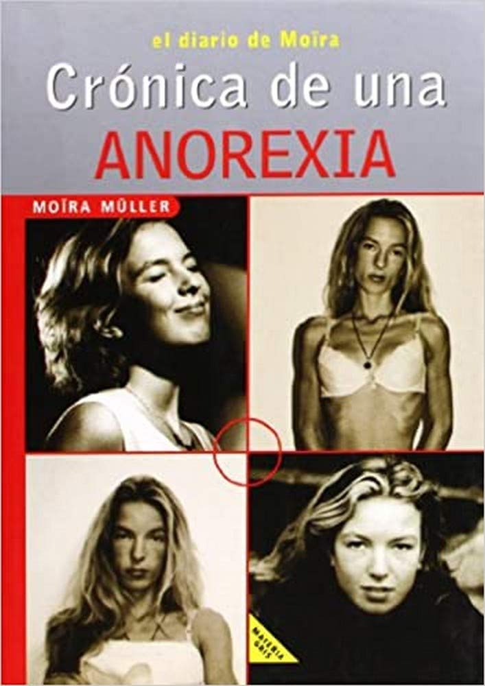 Crónica de una anorexia