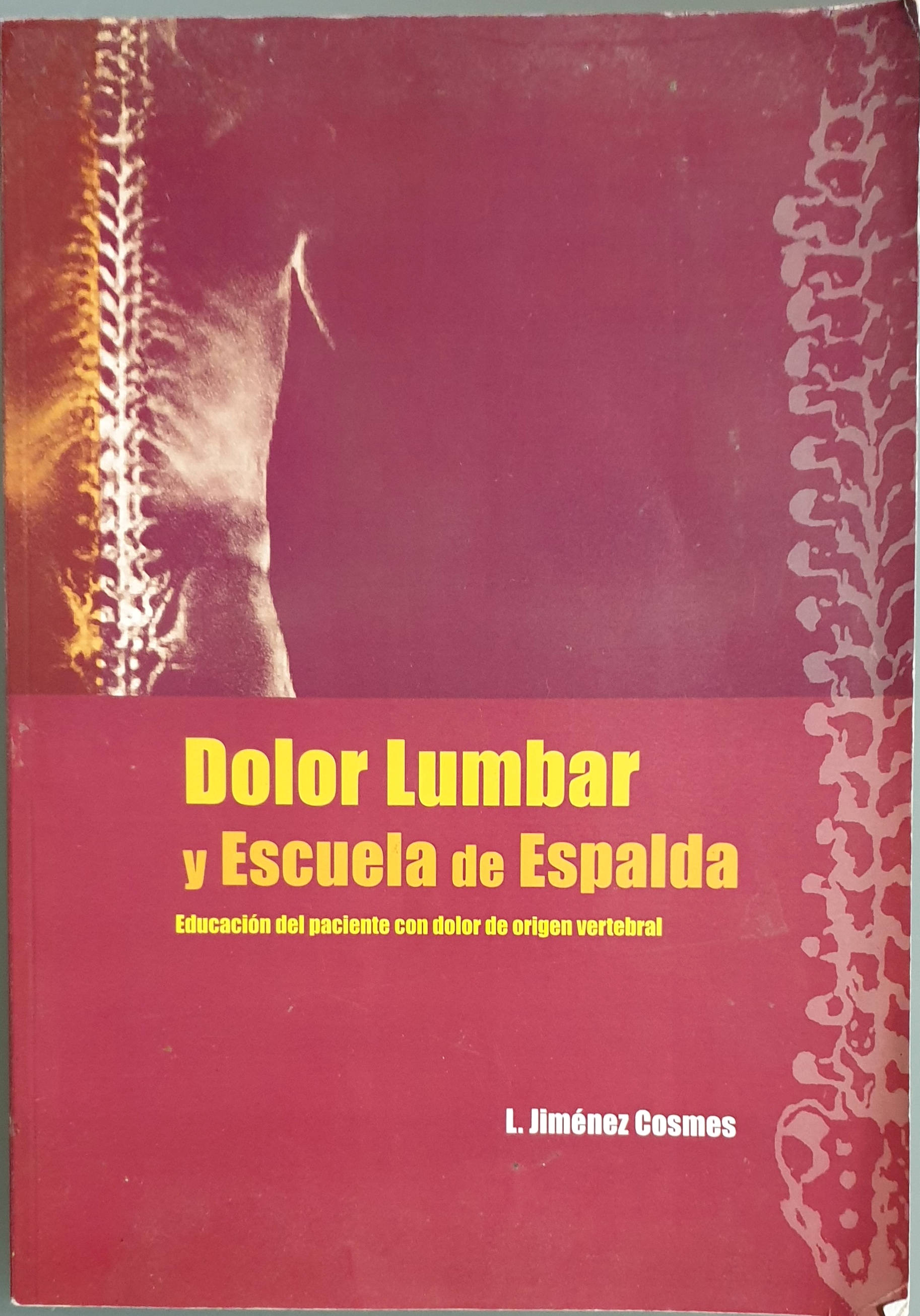 Dolor Lumbar y Escuela de Espalda