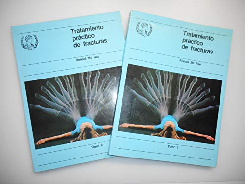 Tratamiento práctico de fracturas