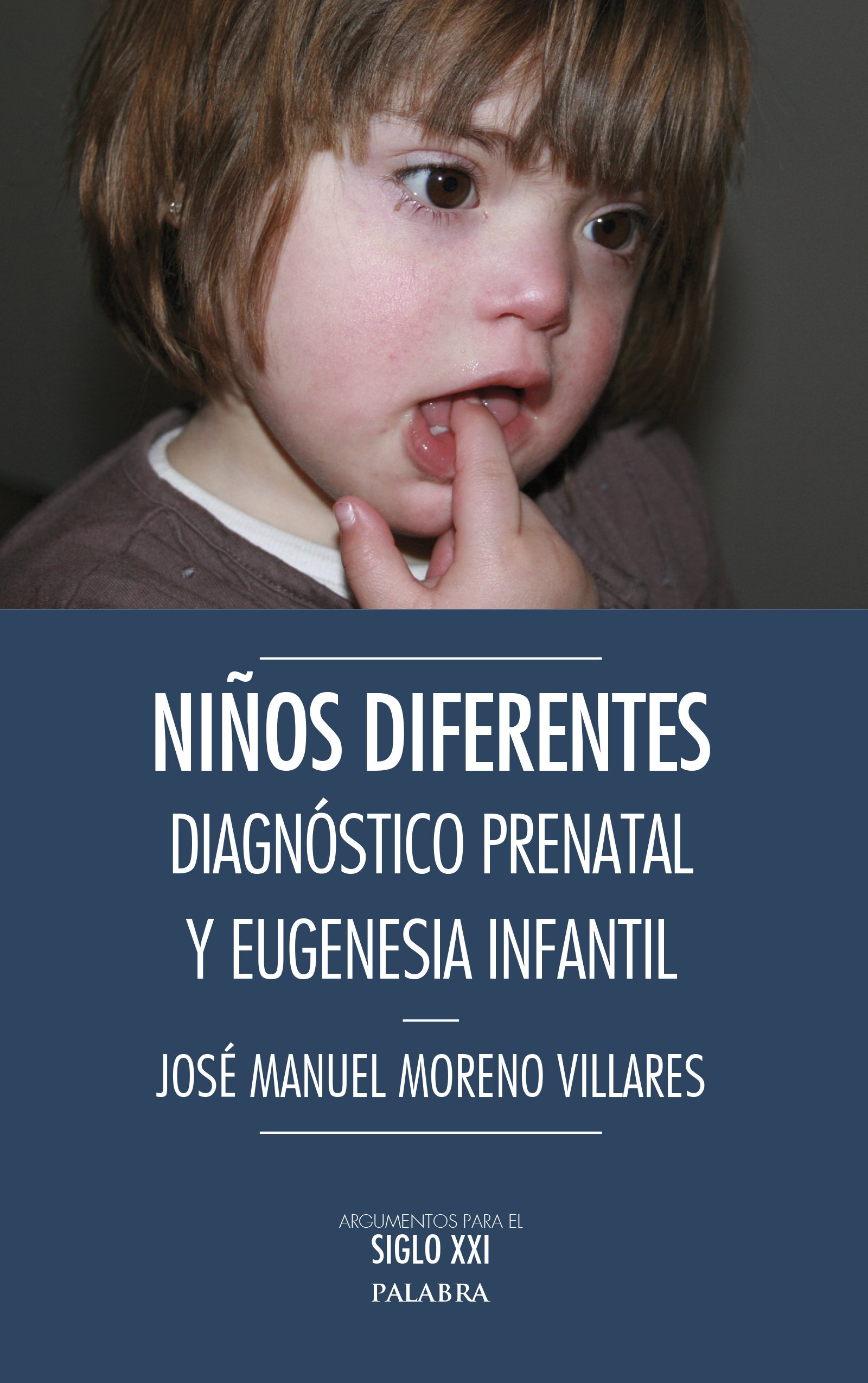 Niños diferentes