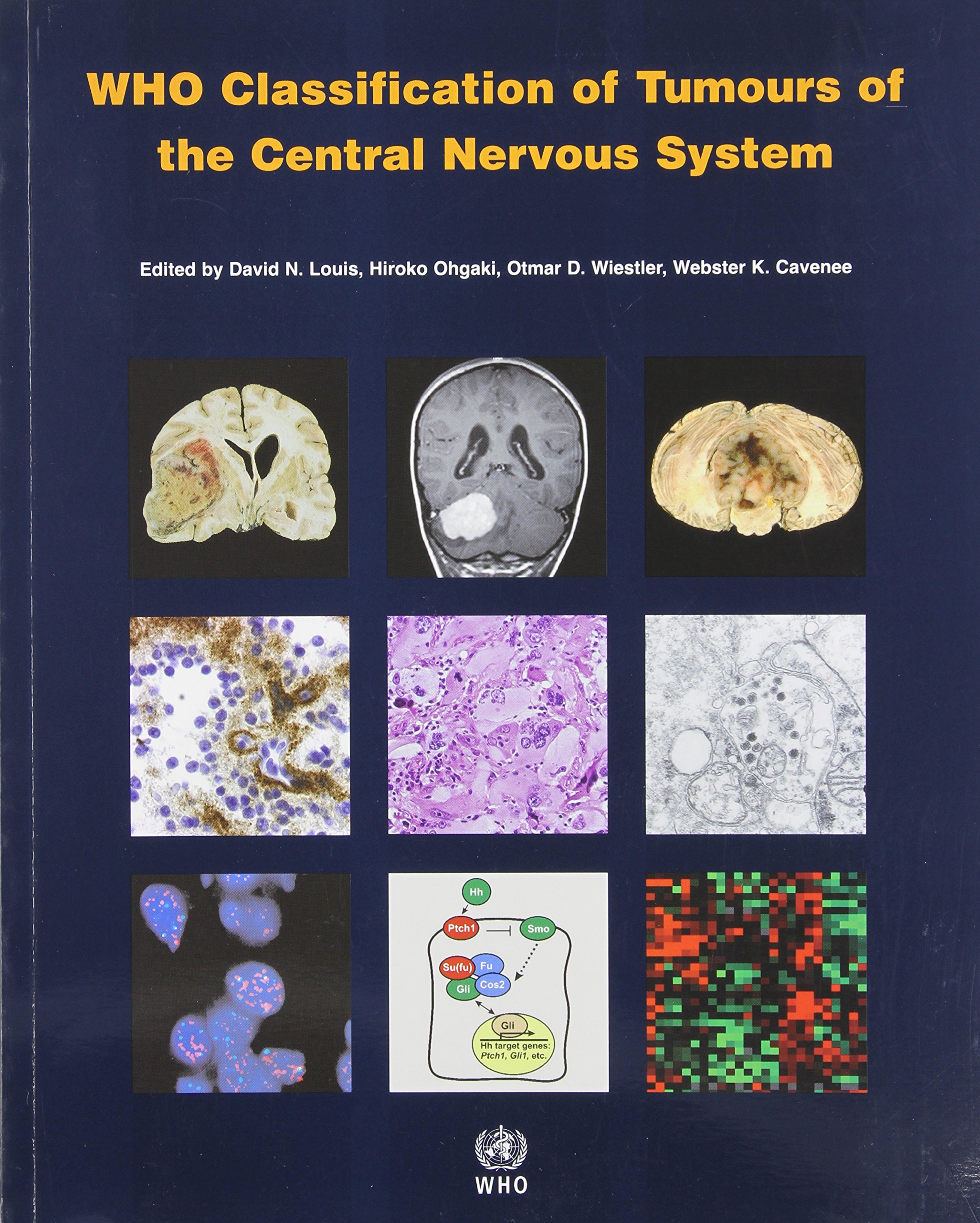 Who Classification of Tumours of The Central Nervous System