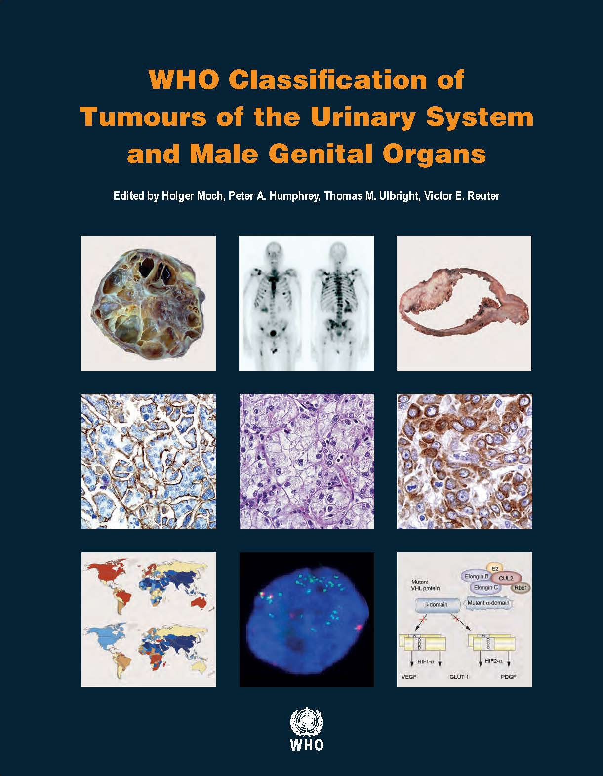 Urinary System And Male Genital Organs: