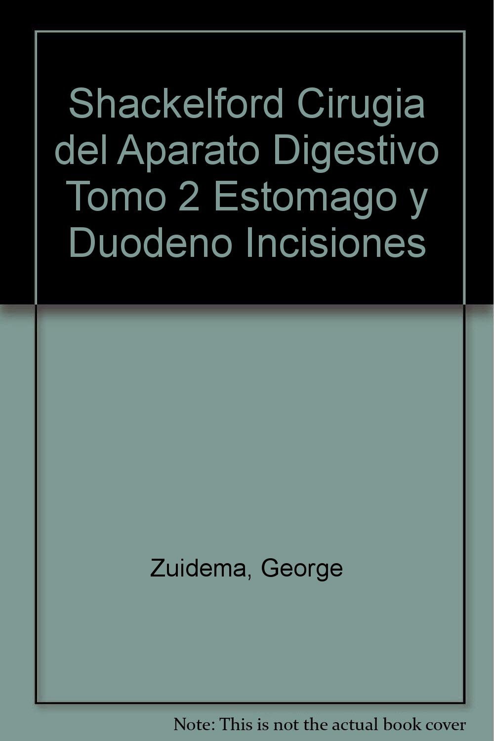 Cirugía Del Aparato Digestivo. Volumen 2: Estómago y Duodeno