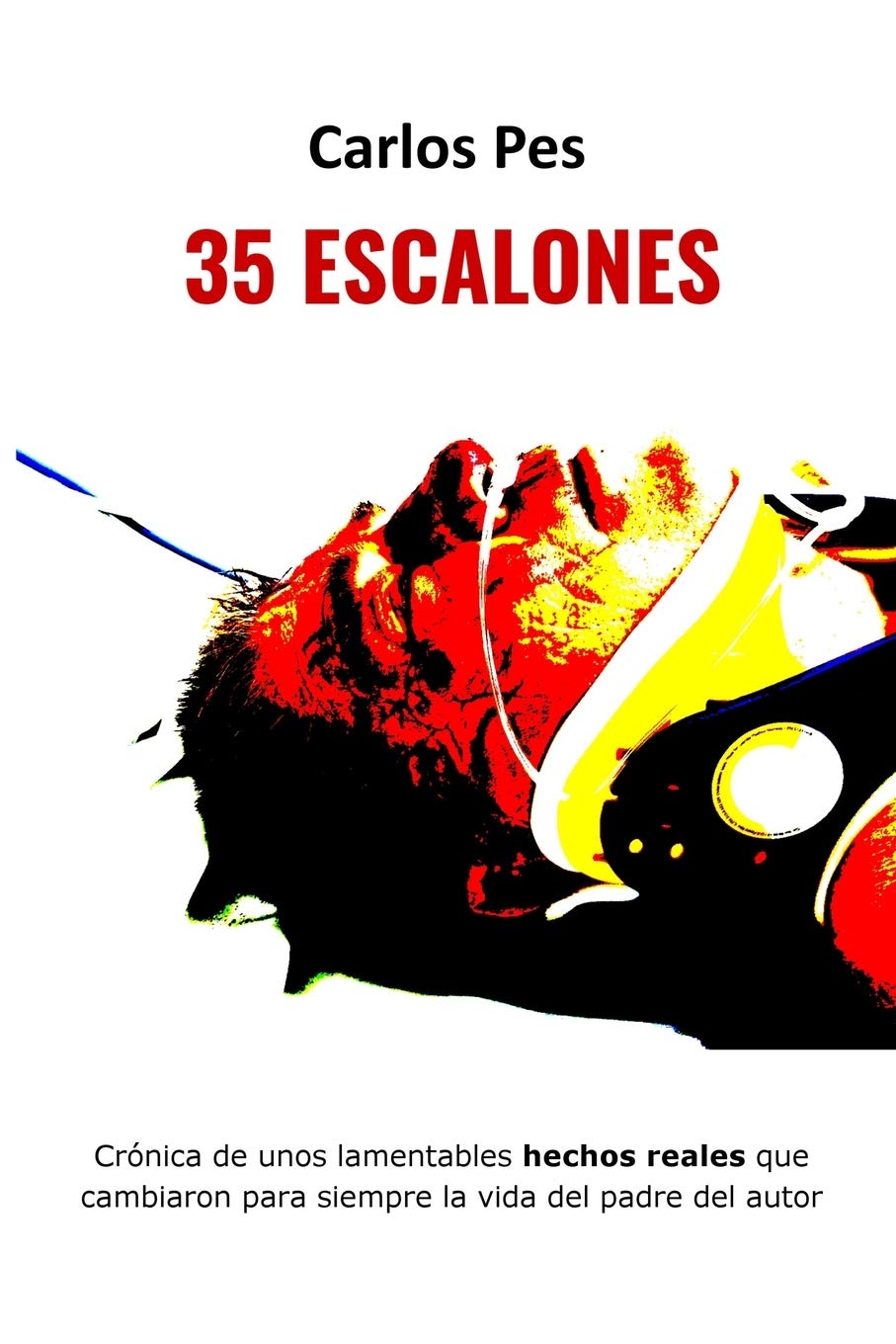 35 Escalones: 1